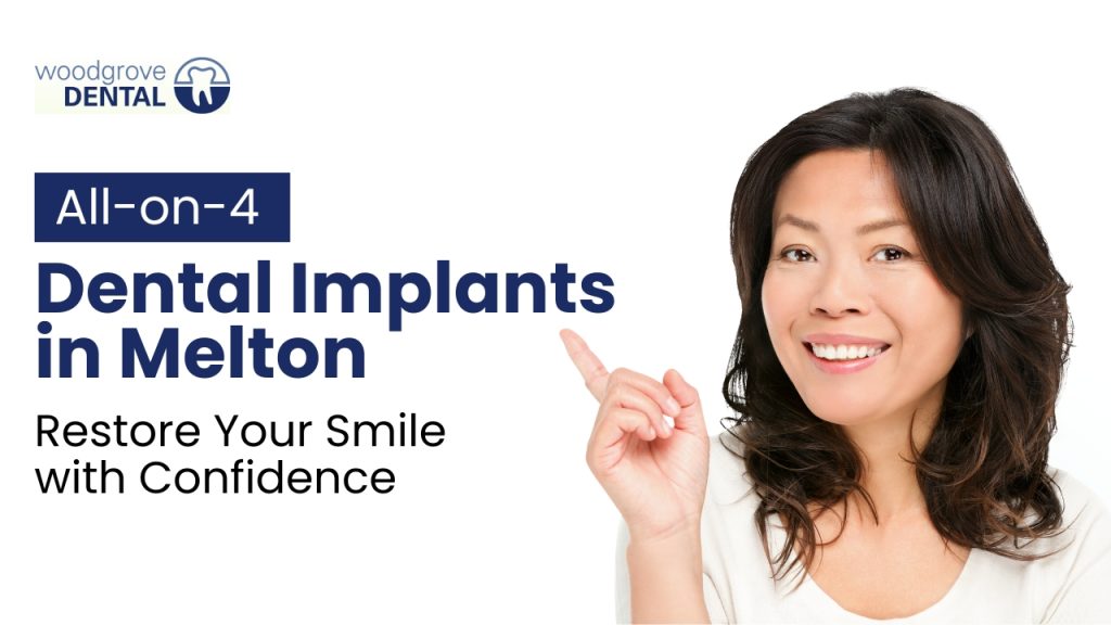 All-on-4 Dental Implants Melton – Restore Your Smile with Confidence