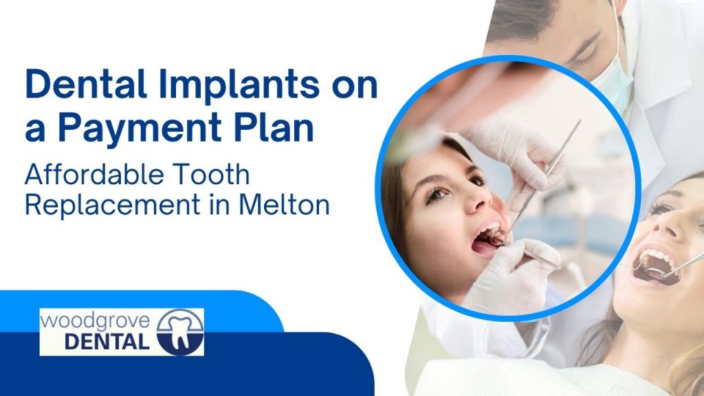 Dental implants on a payment plan
