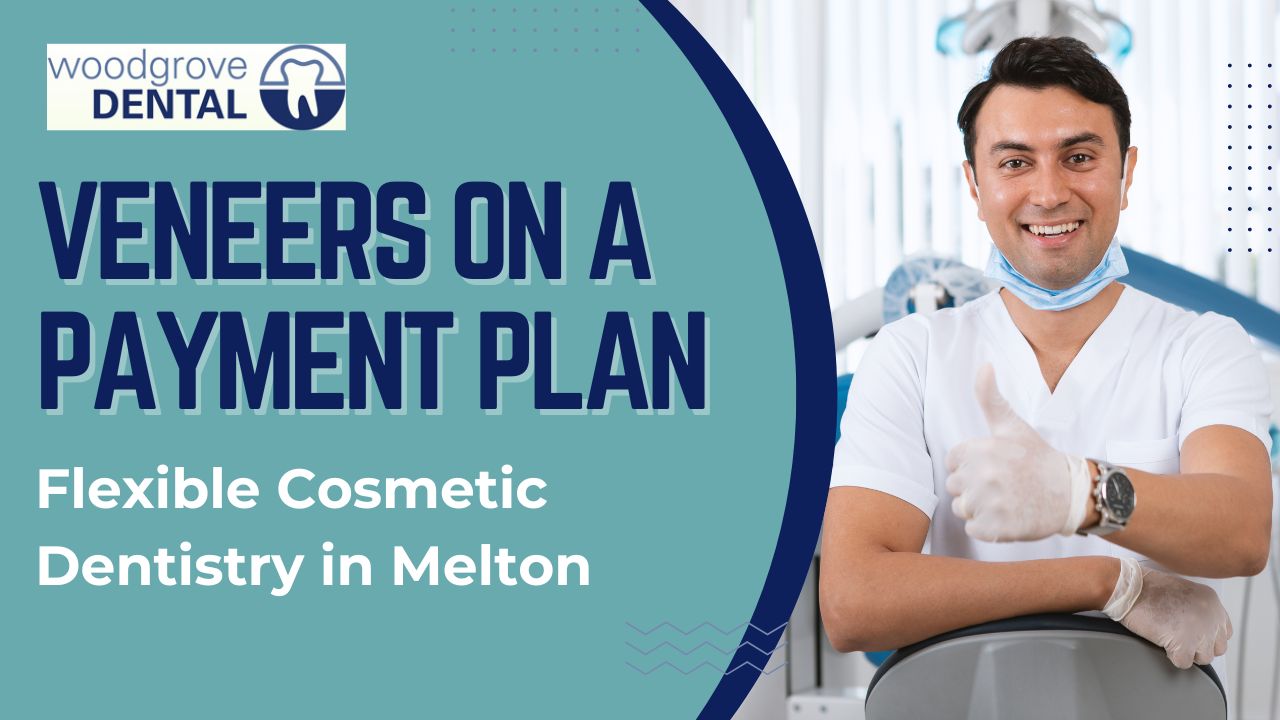 Veneers on a payment plan