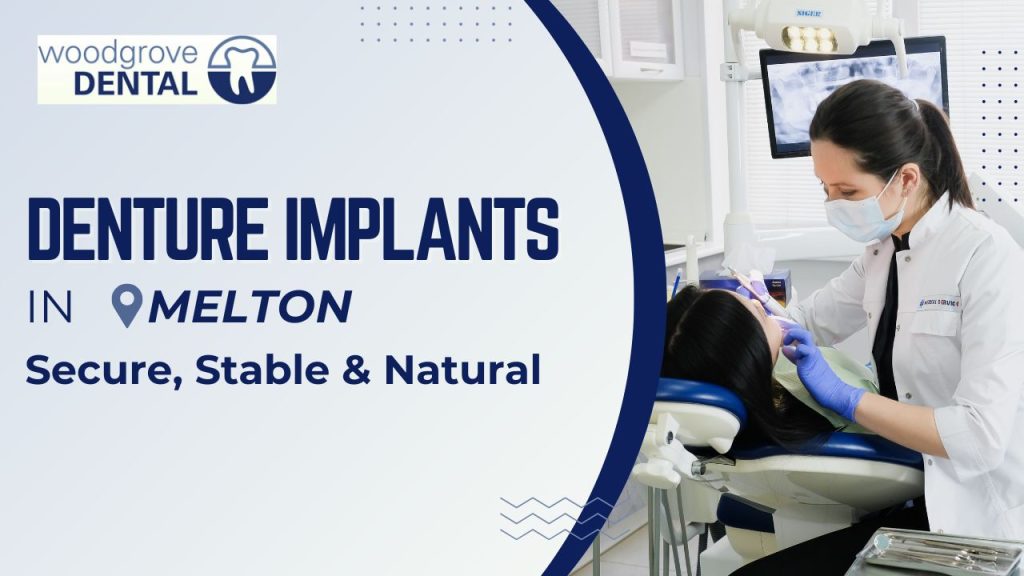 Denture implants Melton