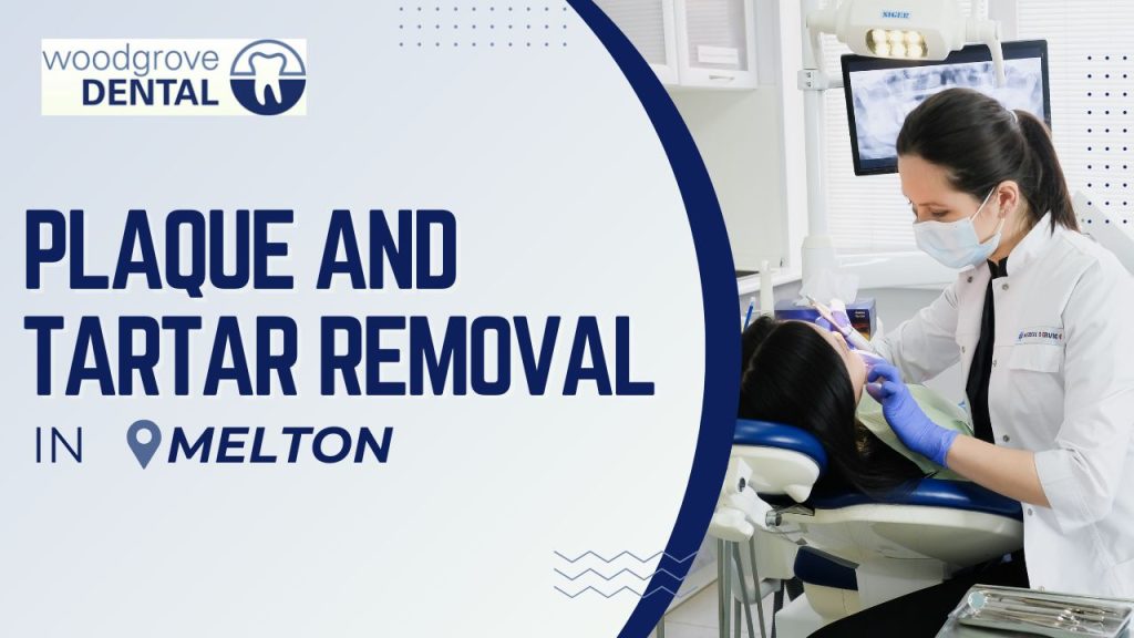 Plaque and tartar removal Melton