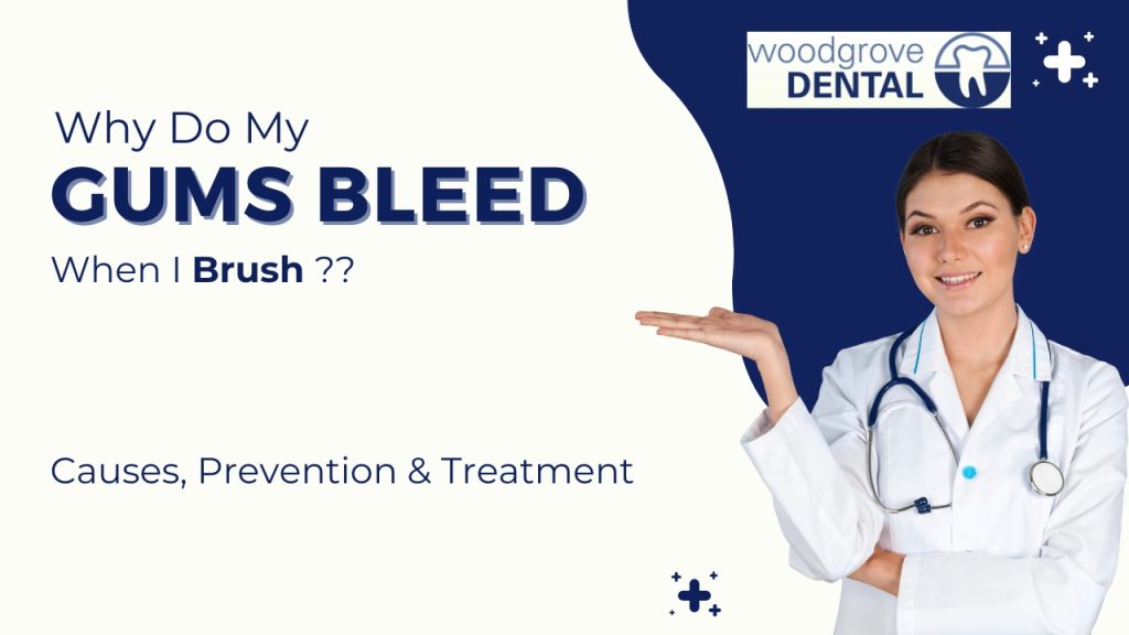 Why Do My Gums Bleed When I Brush? Causes, Prevention & Treatment