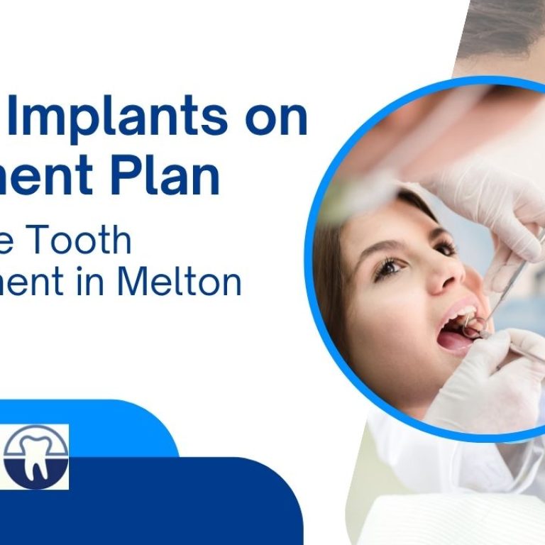 Dental implants on a payment plan