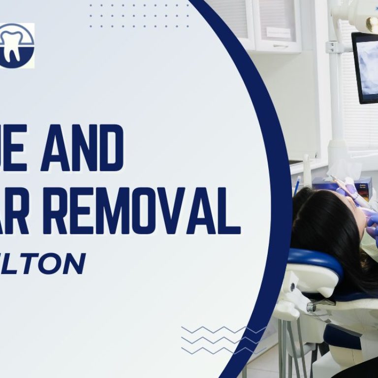 Plaque and tartar removal Melton